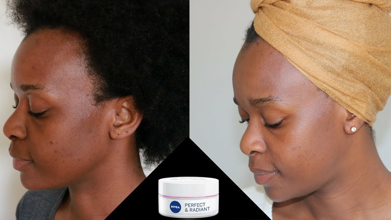 How to Visibly Reduce and Dark Spots | Nivea Perfect and Radiant Day Cream SPF 15 REVIEW - YouTube