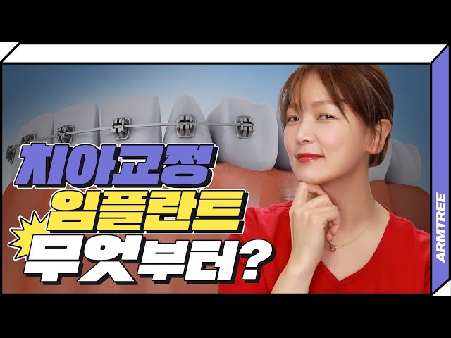 임플란트와 치아교정 순서와 가능여부! 제대로 알자!