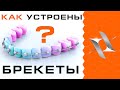 КАК РАБОТАЮТ БРЕКЕТЫ | Устройство брекет-системы