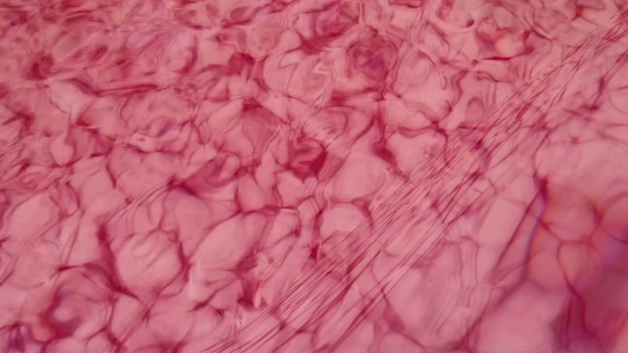 Gif 1 - Abstract Inversions