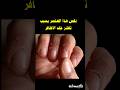 اسباب تقشر الجلد حول الاظافر Shorts Trending Viral طبيب مفلسdrmuflis Drmuflis اسباب تقشر الجلد حول الاظافر Shorts Trending Viral طبيب مفلسdrmuflis Drmuflis