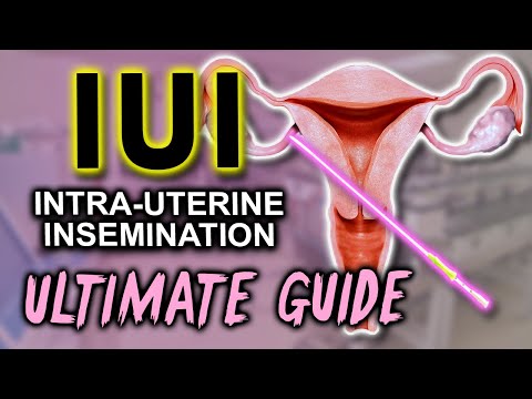 IUI  Fertility expert secrets for maximum pregnancy rates