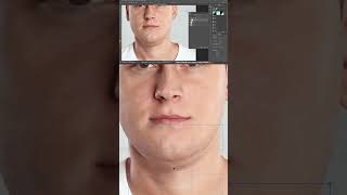 How to Remove double chin