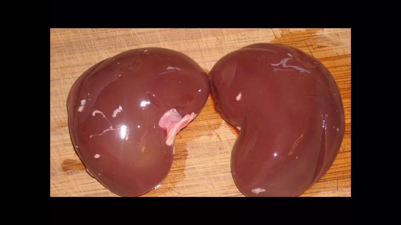 Фотографии как выглядит настоящий Digestive and Excretory System - YouTube