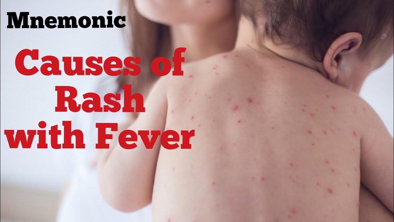 What causes Skin rashes with fever in children. Mnemonic - YouTube