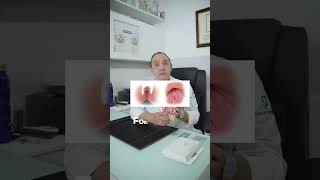 I'll explain the differences between anal abscess, anal fissure, and anal fistula in a clear and ...
