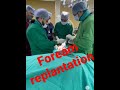 Foream Replantation #forearmamputation #savinglives #savinglimbs #orthopedics
