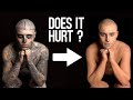 Why It&#39;s So Hard To Remove Tattoos