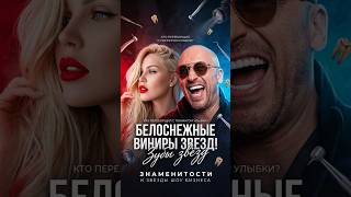 ОСЛЕПИТЕЛЬНО ИЛИ ИСКУССТВЕННО?! Зубы звезд, которые светятся со сцены #знаменитости #знайобовсем