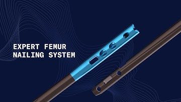 The Expert Femur Nailing System Intro