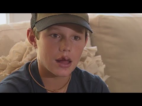 Shark bites boy's face while lobstering: 'I looked behind me and the shark was in my face'