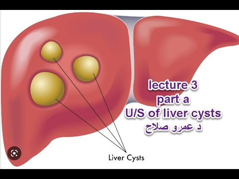 Abdominal U S Course Lecture 3 Part A Liver Cyst د عمرو صلاح 