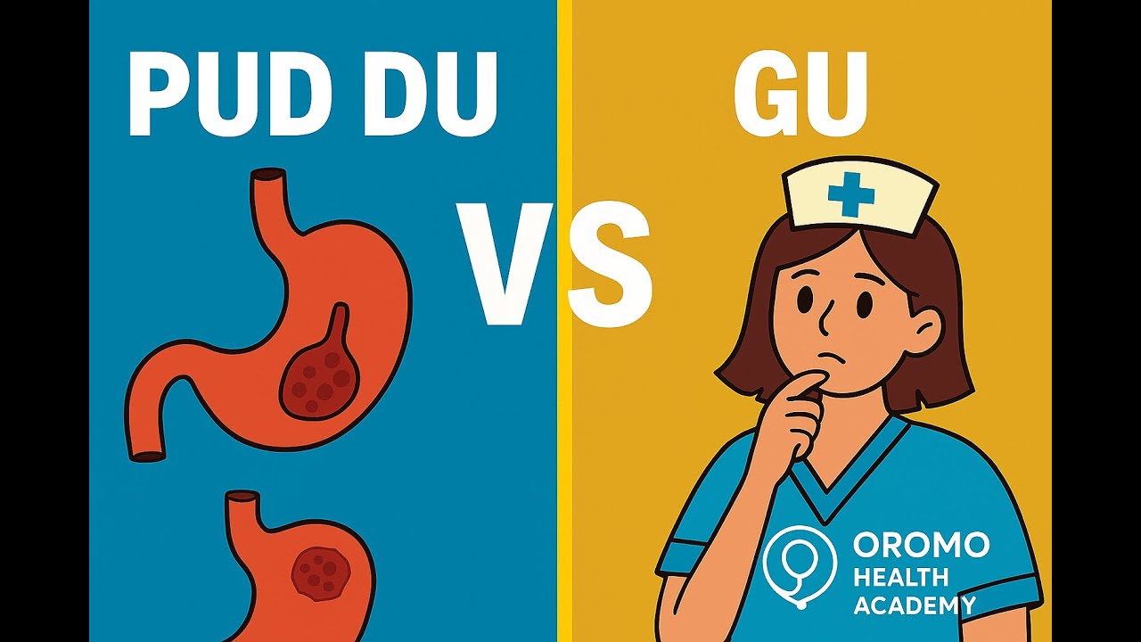 Nursing Exam Shortcut: PUD DU vs GU Mnemonic