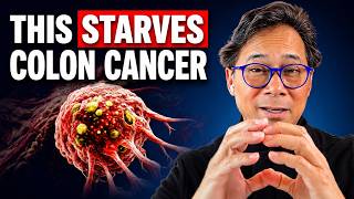 The SHOCKING ROOT CAUSE of Cancer & How To STARVE It! | Dr. William Li