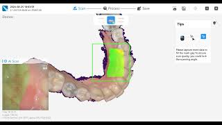 Scan protocol - Elephant V3+ Scanner