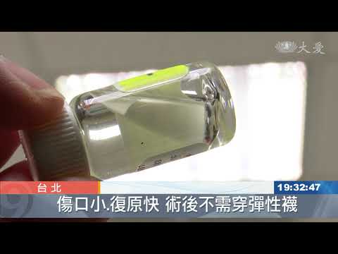 蚯蚓爬上腿 靜脈曲張新療法