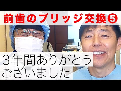 前歯のブリッジ交換⑤３年間ありがとうございました｜ブリッジと犬歯を修復して治療終了【歯列矯正後の治療】