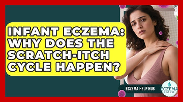 Infant Eczema: Why Does The Scratch-Itch Cycle Happen? - Eczema Help Hub