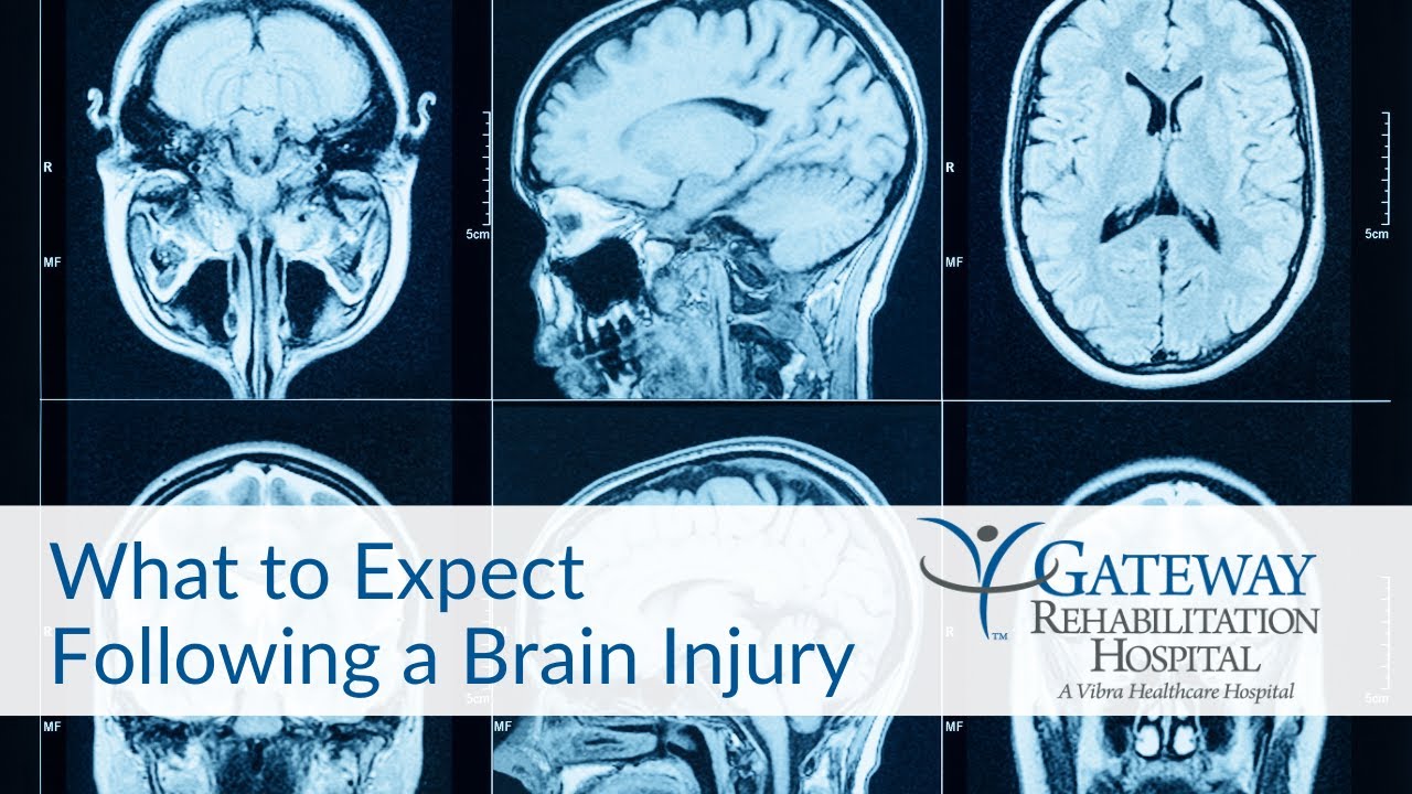 What to Expect Following a Brain Injury | Gateway Rehabilitation ...