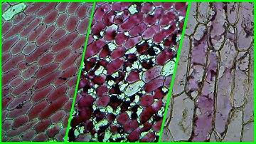 Osmosis in Red Onion Cells