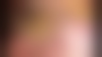 Unisurgeon Uniportal VATS anatomic S1 with magnetic grasper