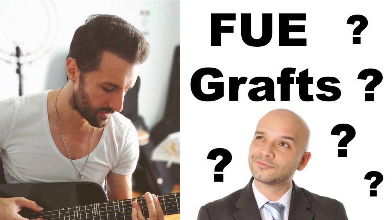 How Many FUE Grafts Can You Have In One Hair Transplant Surgery?