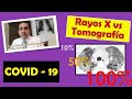 Rayos X y Tomografía en pacientes con COVID 19