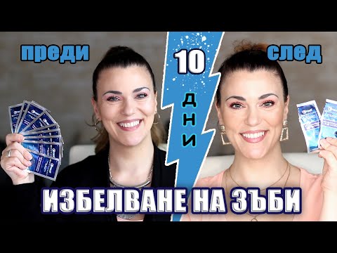 По-бели зъби за 10 дни вкъщи? Възможно ли е? Десетдневен тест на ленти за избелване Crest