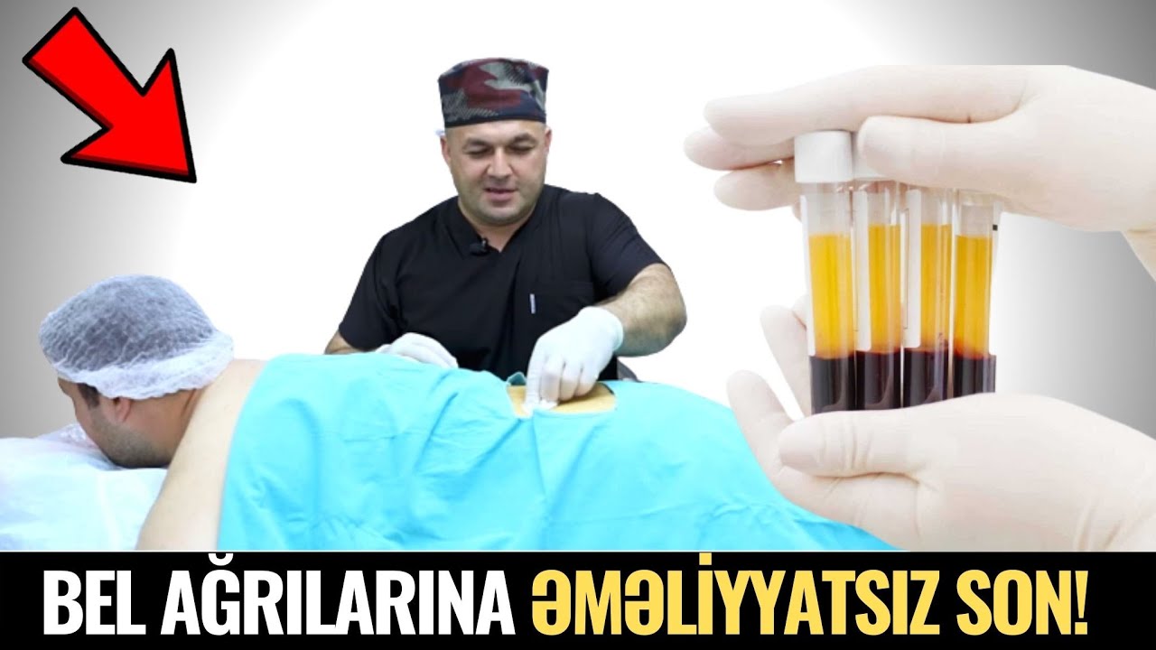 Bel Yırtığının Əməliyyatsız Müalicəsi