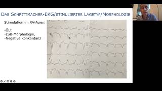 EKG - From Beginner To Boss | Teil 7 | Schrittmacher-EKG - mit Dr. Sebastian Feickert