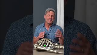 Connected Bars: The Future of Pectus Surgery Revealed! #shorts