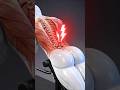 Lower Back Hurting On Hyperextensions 