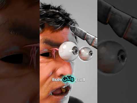 العين عليها حارس اكسبلور ثقف نفسك 