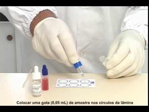 Serological Examination Methods Dental