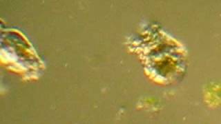 Marble Goby Breeding And Farming-Live Feed Rotifer And Other Zooplankton Seen Under Microscope