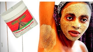 I USED BENTONITE CLAY ON MY ARMPITS & FACE & THIS HAPPENED!!