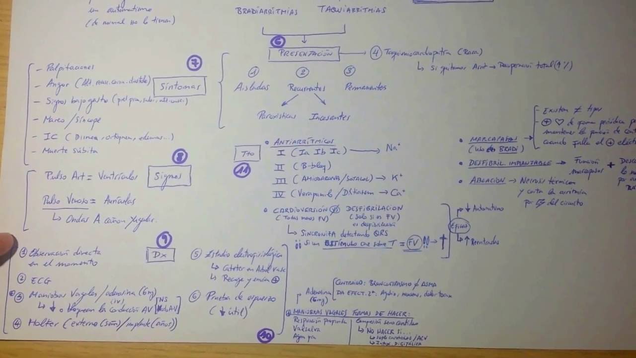 Esquema de Arritmias.