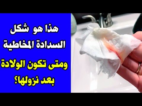هذا هو شكل السدادة المخاطية ومتى تكون الولادة بعد نزولها