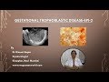 Gestational Trophoblastic Disease ( Video Series-Epi-2)