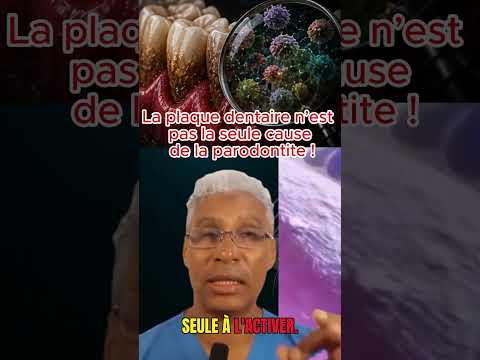 La plaque n'est pas la seule coupable de parodontite!