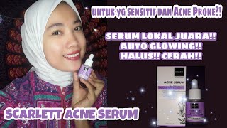 REVIEW SCARLETT WHITENING ACNE SERUM || Baru Coba Langsung Jatuh Cinta