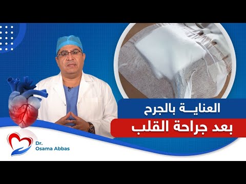 العناية بالجرح بعد جراحة القلب العناية بالجرح بعد عملية القلب المفتوح دكتور اسامة عباس