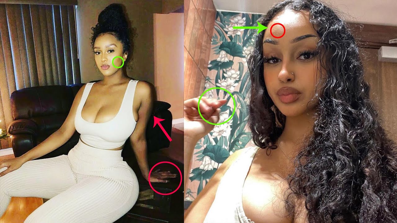 Niba ufite ibibimenyetso wanduye SIDA ntakabuza|ibimenyetso simusiga bihamya ko wanduye SIDA utabizi