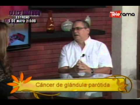 Cáncer de glándula parótida