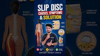 Slip disc — causes,symptoms &amp; solutions explained ❌ #physiotherapy #slipdisc #ytshorts