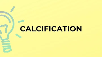 Che cos'è una calcificazione al fegato?