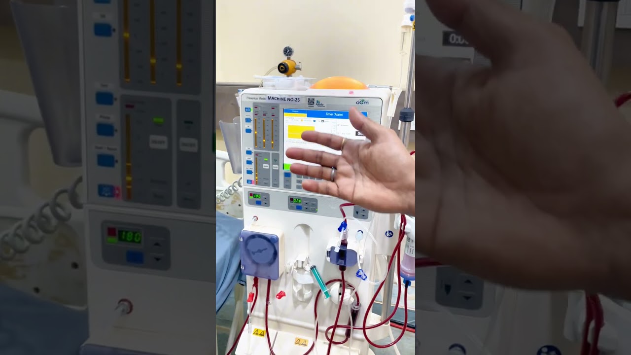 All alarm ditels in dialysis mechine 
