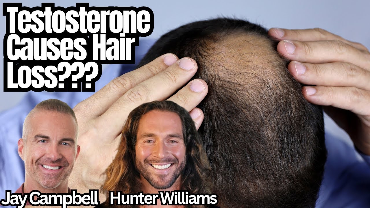 Will Therapeutic Testosterone Make Your Hair Fall Out? YouTube