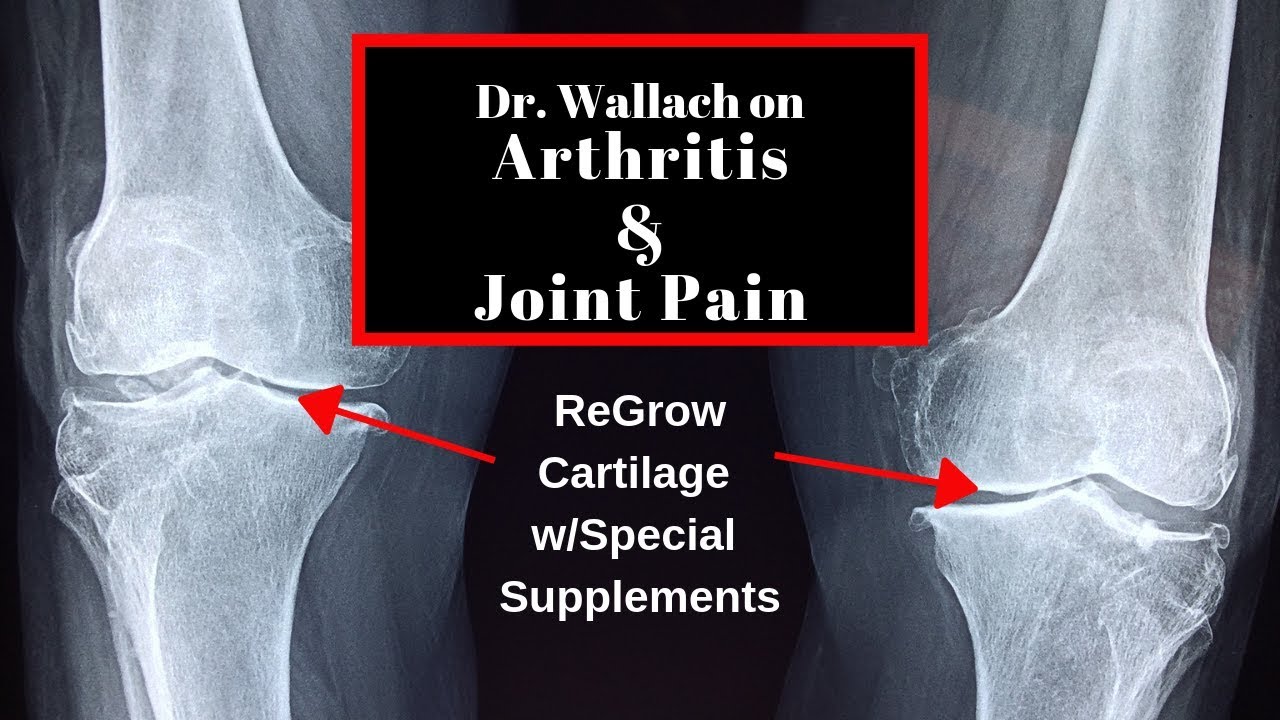 Dr Wallach on Arthritis and Joint Pain YouTube