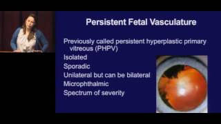 Pediatric Cataracts and Lens Disorders